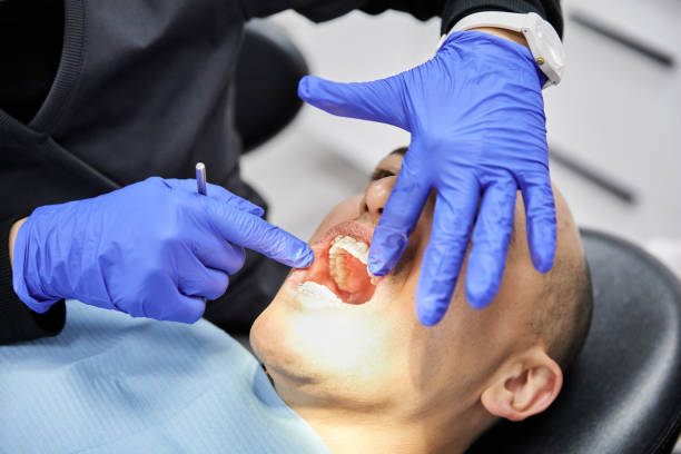Best Urgent Tooth Repair  in South Gate, CA